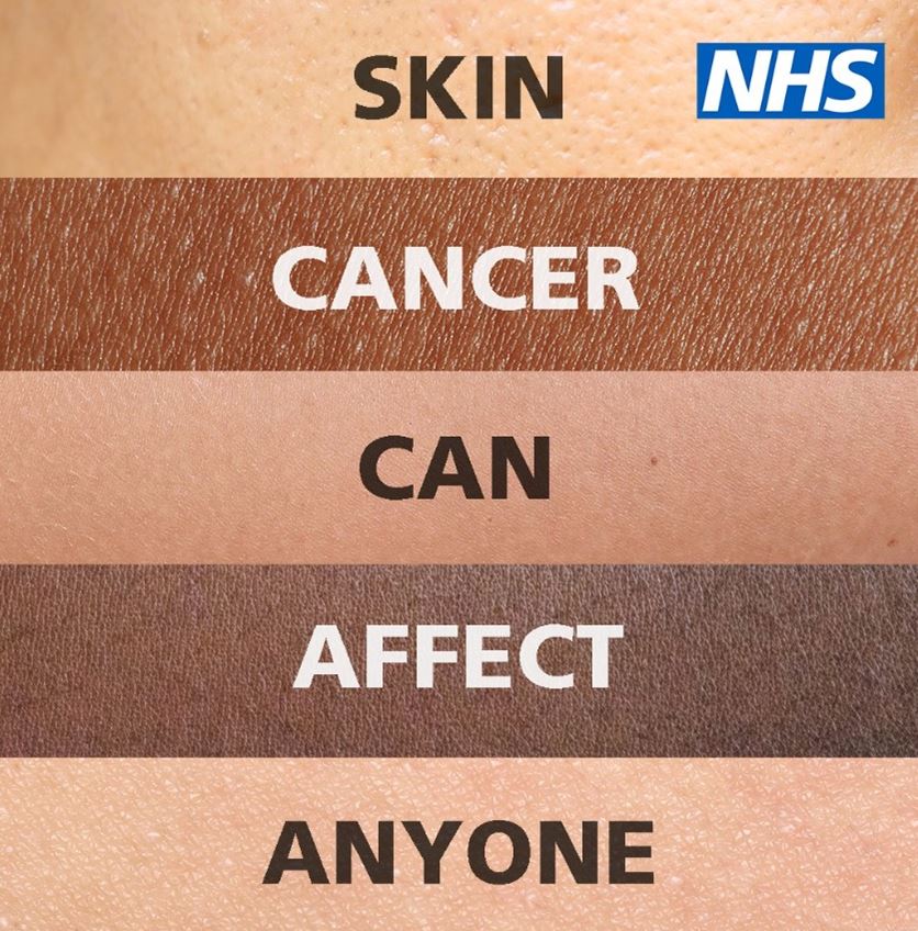 Skin cancer
