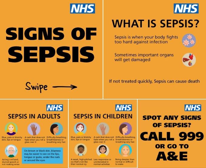 Sepsis