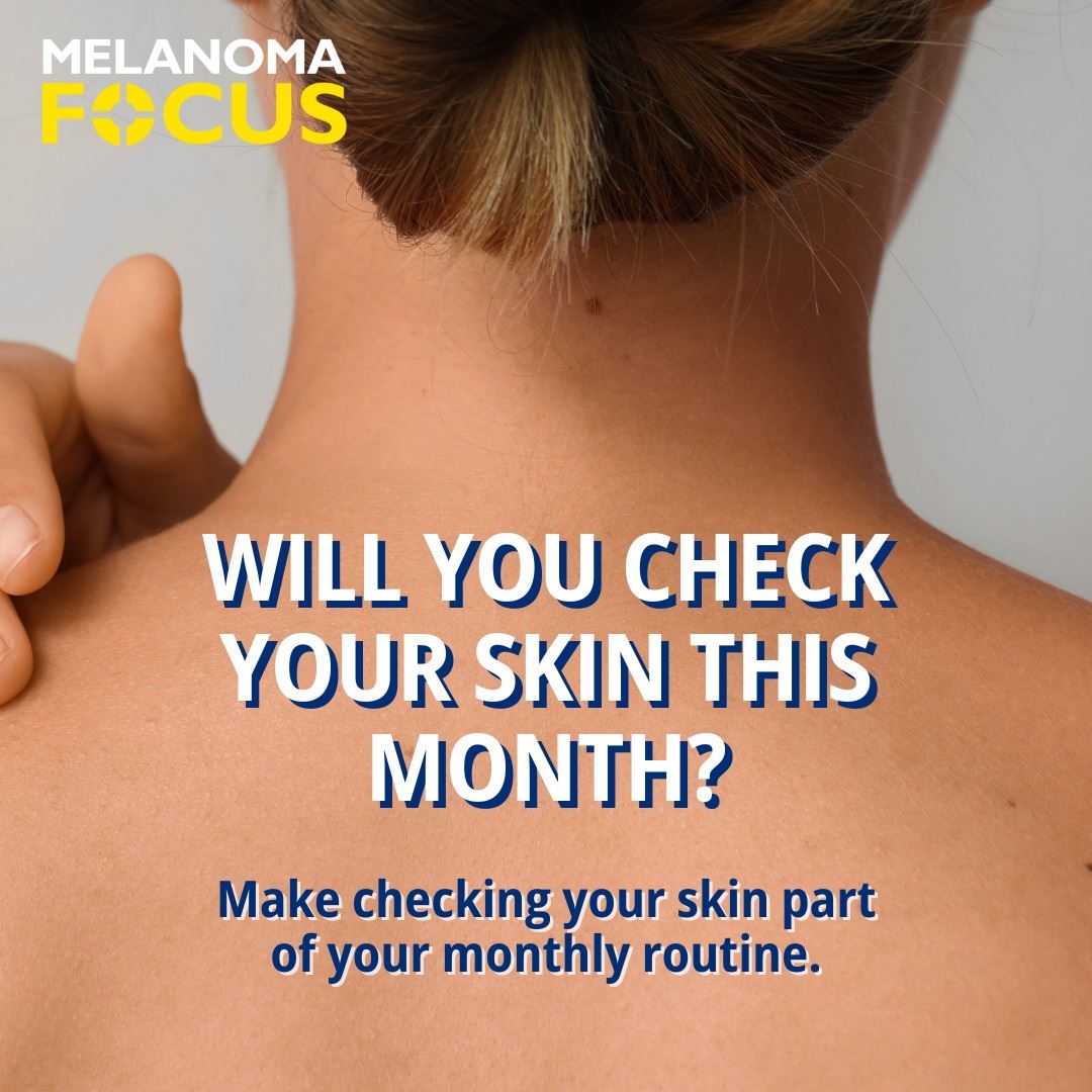Melanoma Focus